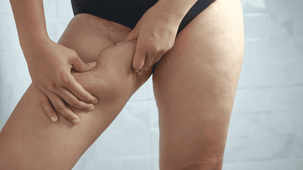 夾腿器有用嗎?它常被針對大腿內側脂肪