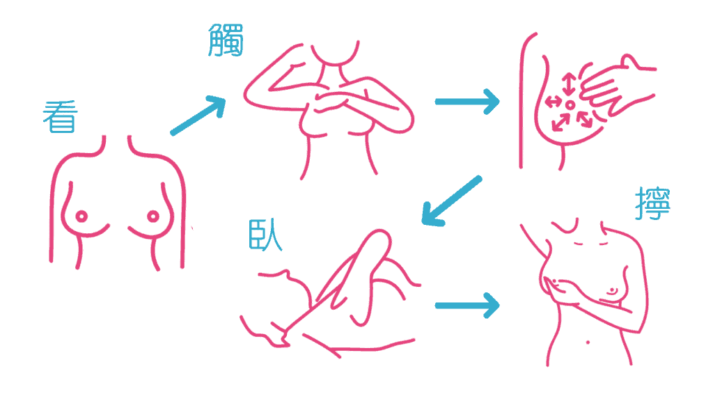 乳房自我檢查若出現乳癌前兆建議至醫院檢查