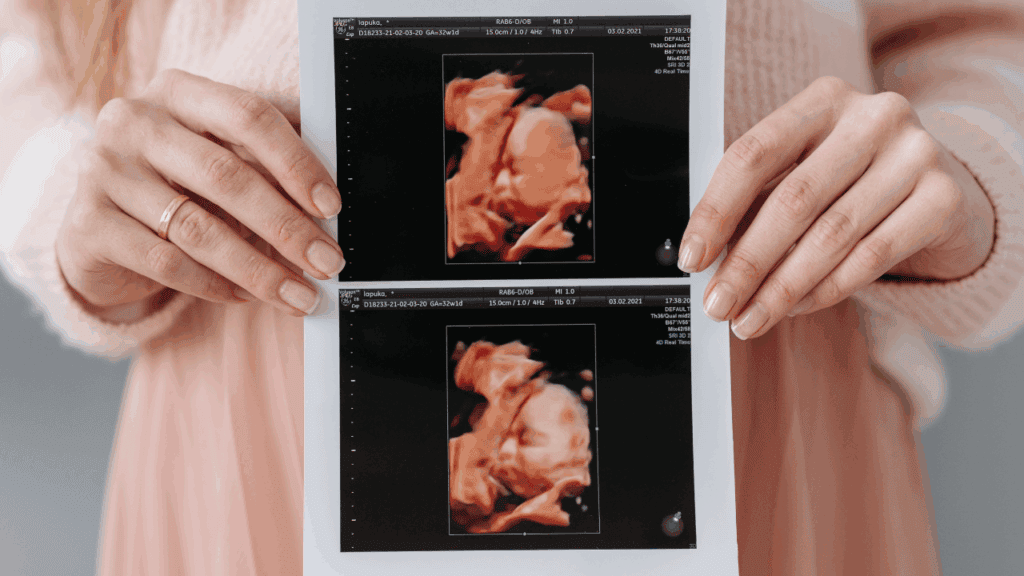 孕婦運動能維持寶寶健康