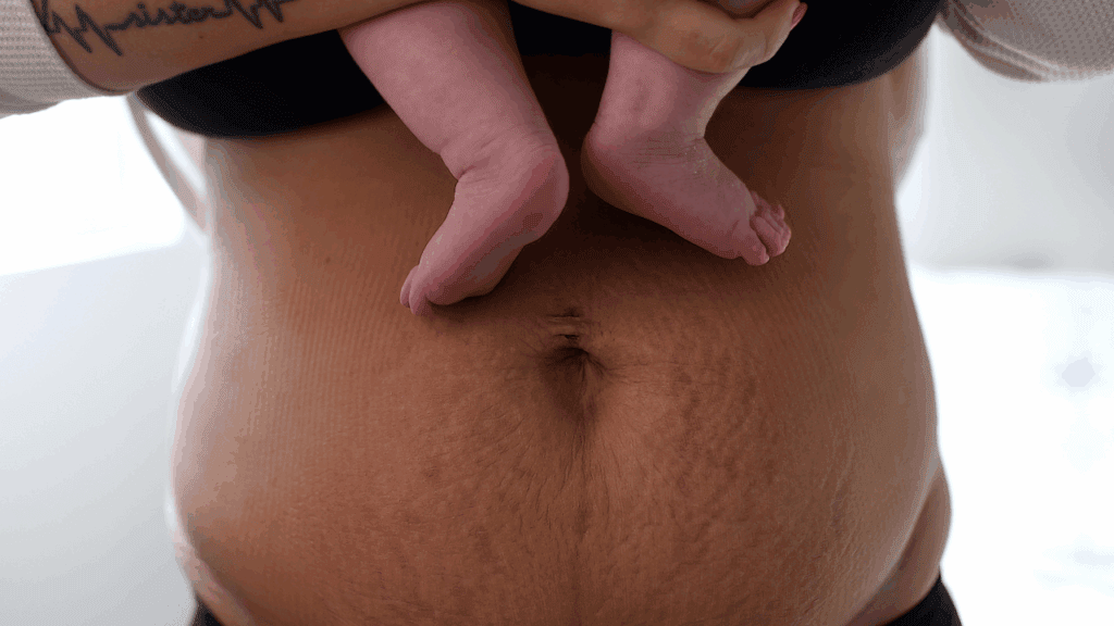 生完肚子還是很大，因為子宮回復需要時間。