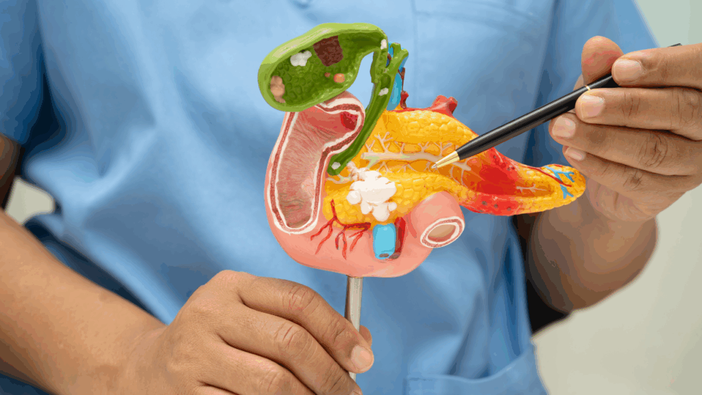 胰臟位於腹部深處，初期症狀不明顯。